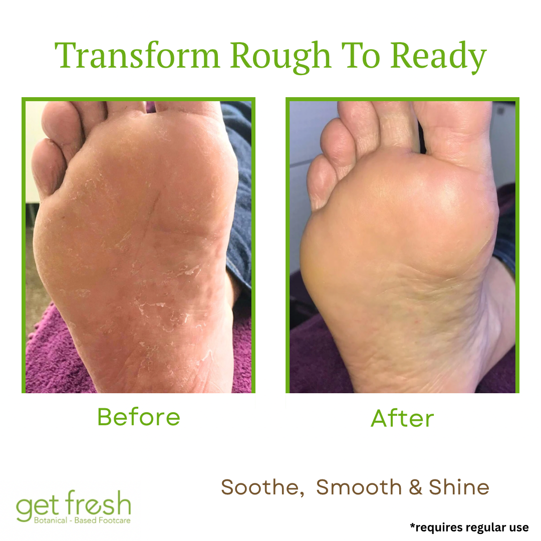 Rescue Me Foot Repair Creme Travel Size - 56g